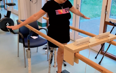 Mijn ervaringen met osseointegratie