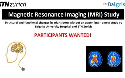 Gezocht voor onderzoek: mensen met dysmelie aan een van de armen