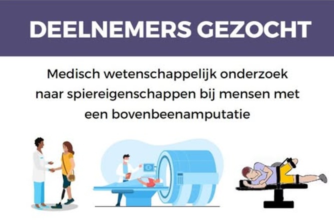 Mensen met een bovenbeenamputatie gezocht