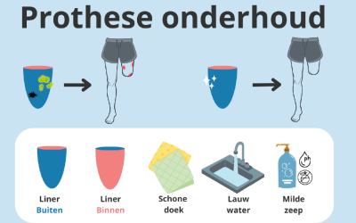 Deelnemers gezocht: Infographic over hoe je je prothese verzorgt